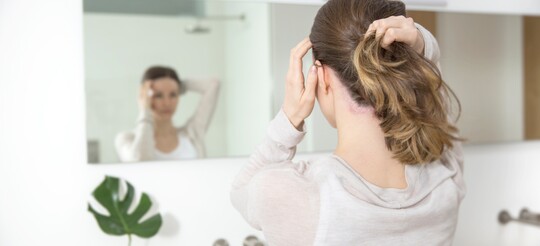 Frau mit Psoriasis am Ohr