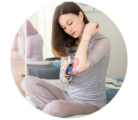 Eine Frau behandelt ihre Schuppenflechte am Ellenbogen mit der Sprühflasche