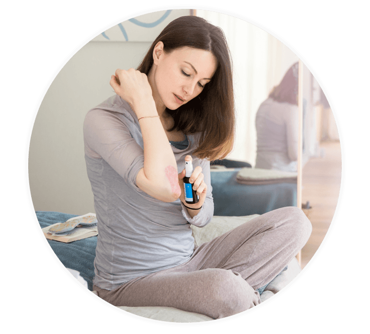 Frau behandelt ihre Schuppenflechte mit LOYON®