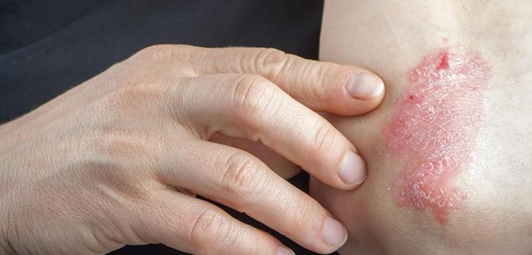 Mann mit Plaques am Arm