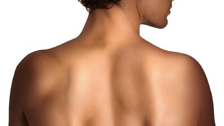 Frauenrücken ohne Schuppen. Sie fühlt sich nach der Behandlung und der Entfernung der Schuppen wieder wohl in ihrer Haut.