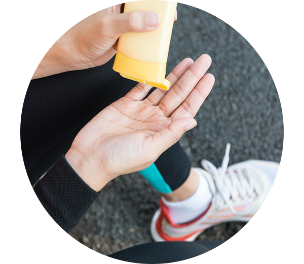 Frau mit Schuppenflechte cremt ihre Haut vor dem Sport mit Sonnencreme ein.