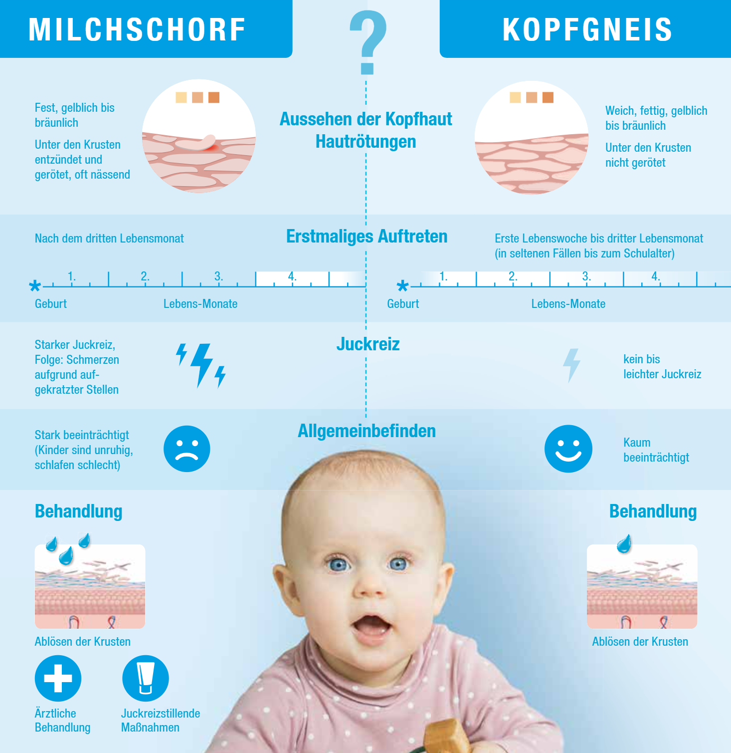 Infografik: Hat mein Baby Milchschorf oder Kopfgneis? Infografik: Hat mein Baby Milchschorf oder Kopfgneis?