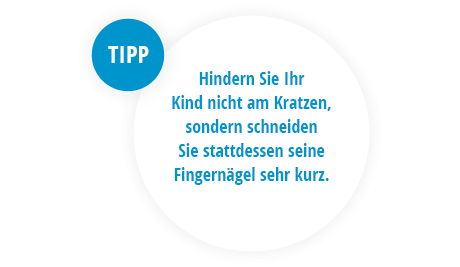 Tipp: Hindern Sie Ihr Kind nicht am Kratzen, sondern schneiden Sie stattdessen seine Fingernägel sehr kurz