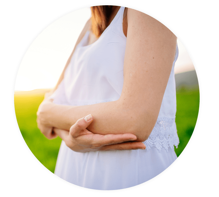 Frau im Sommerkleid ohne Schuppenflechte am Arm